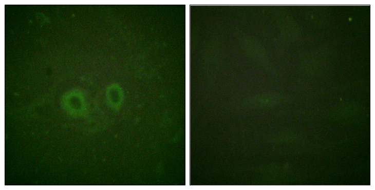 RET Antibody - Immunofluorescence analysis of HUVEC cells, using Ret Antibody. The picture on the right is blocked with the synthesized peptide.