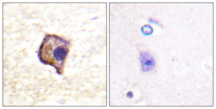 RET Antibody - Immunohistochemistry analysis of paraffin-embedded human brain, using Ret Antibody. The picture on the right is blocked with the synthesized peptide.