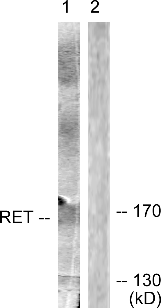 RET Antibody - Western blot analysis of lysates from Jurkat cells, using Ret Antibody. The lane on the right is blocked with the synthesized peptide.