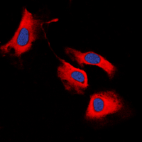 RET Antibody - Immunofluorescent analysis of RET staining in MCF7 cells. Formalin-fixed cells were permeabilized with 0.1% Triton X-100 in TBS for 5-10 minutes and blocked with 3% BSA-PBS for 30 minutes at room temperature. Cells were probed with the primary antibody in 3% BSA-PBS and incubated overnight at 4 deg C in a humidified chamber. Cells were washed with PBST and incubated with a DyLight 594-conjugated secondary antibody (red) in PBS at room temperature in the dark. DAPI was used to stain the cell nuclei (blue).