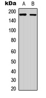 RET Antibody - Western blot analysis of RET expression in K562 (A); HeLa (B) whole cell lysates.