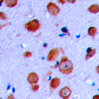 RET Antibody - Immunohistochemical analysis of RET staining in human brain formalin fixed paraffin embedded tissue section. The section was pre-treated using heat mediated antigen retrieval with sodium citrate buffer (pH 6.0). The section was then incubated with the antibody at room temperature and detected using an HRP-conjugated compact polymer system. DAB was used as the chromogen. The section was then counterstained with hematoxylin and mounted with DPX.