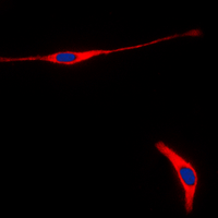 RET Antibody - Immunofluorescent analysis of RET staining in HeLa cells. Formalin-fixed cells were permeabilized with 0.1% Triton X-100 in TBS for 5-10 minutes and blocked with 3% BSA-PBS for 30 minutes at room temperature. Cells were probed with the primary antibody in 3% BSA-PBS and incubated overnight at 4 deg C in a humidified chamber. Cells were washed with PBST and incubated with a DyLight 594-conjugated secondary antibody (red) in PBS at room temperature in the dark. DAPI was used to stain the cell nuclei (blue).