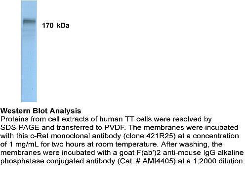 RET Antibody - WB using c-Ret Antibody (421R25)
