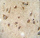 RET Antibody - RET Monoclonal( Ascites) immunohistochemistry of formalin-fixed and paraffin-embedded human brain tissue followed by peroxidase-conjugated secondary antibody and DAB staining.