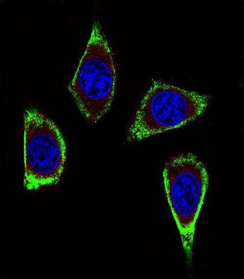 RET Antibody - Confocal immunofluorescence of RET Antibody (Ascites) with MDA-MB231 cell followed by Alexa Fluor 488-conjugated goat anti-mouse lgG (green). Actin filaments have been labeled with Alexa Fluor? 555 phalloidin (red). DAPI was used to stain the cell nuclear (blue).