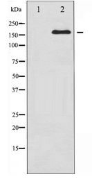 RET Antibody - Western blot of Ret expression in K562 whole cell lysates,The lane on the left is treated with the antigen-specific peptide.