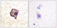 RET Antibody - Peptide - + Immunohistochemistry analysis of paraffin-embedded human brain tissue using Ret (Ab-905) antibody.
