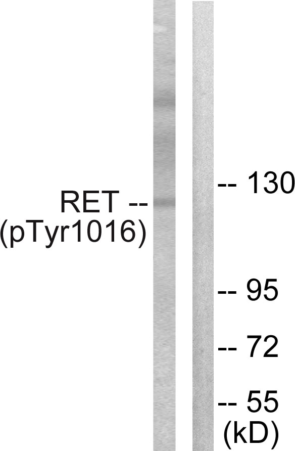 RET Antibody - Western blot analysis of lysates from COS7 cells treated with EGF 200ng/ml 30', using Ret (Phospho-Tyr1015) Antibody. The lane on the right is blocked with the phospho peptide.