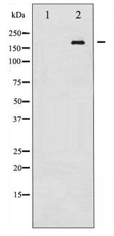 RET Antibody - Western blot of Ret phosphorylation expression in K562 whole cell lysates,The lane on the left is treated with the antigen-specific peptide.