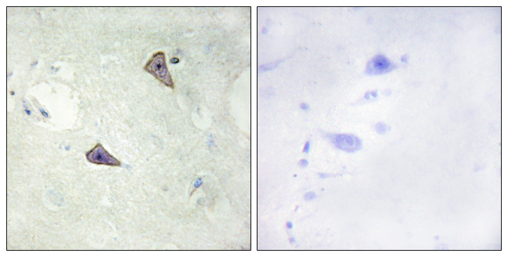 RET Antibody - Immunohistochemistry analysis of paraffin-embedded human brain, using Anti-RET Antibody (phospho-Tyr905). The picture on the right is blocked with the phospho peptide.