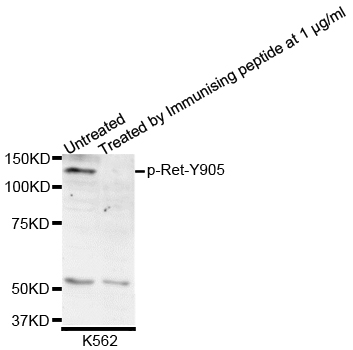 RET Antibody - Western blot analysis of extracts of K562 cells.