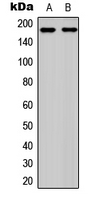 RET Antibody - Western blot analysis of RET (pY1062) expression in K562 (A); mouse brain (B) whole cell lysates.