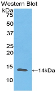 RETN / Resistin Antibody - Western blot of recombinant RETN / Resistin.  This image was taken for the unconjugated form of this product. Other forms have not been tested.