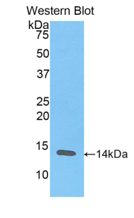 RETN / Resistin Antibody - Western blot of recombinant RETN / Resistin.  This image was taken for the unconjugated form of this product. Other forms have not been tested.