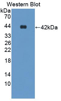 RETN / Resistin Antibody - Western blot of RETN / Resistin antibody.