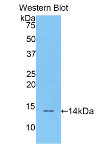 RETN / Resistin Antibody - Western blot of recombinant RETN / Resistin.  This image was taken for the unconjugated form of this product. Other forms have not been tested.