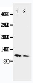 RETN / Resistin Antibody - WB of RETN / Resistin antibody. All lanes: Anti-RETN at 0.5ug/ml. Lane 1: Recombinant Mouse Resistin Protein 10ng. Lane 2: Recombinant Mouse Resistin Protein 5ng. Predicted bind size: 10KD. Observed bind size: 10KD.