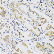 RETN / Resistin Antibody - Immunohistochemistry of paraffin-embedded human stomach tissue.