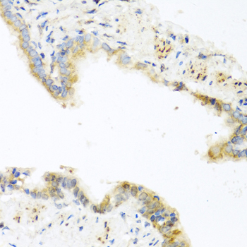 RETN / Resistin Antibody - Immunohistochemistry of paraffin-embedded mouse lung tissue.