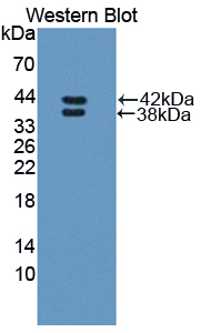 RETNLB / RELM-Beta Antibody - Western blot of RETNLB / RELM-Beta antibody.