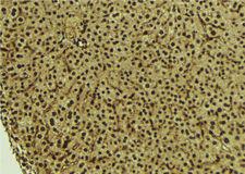 REV1 Antibody - 1:100 staining mouse liver tissue by IHC-P. The sample was formaldehyde fixed and a heat mediated antigen retrieval step in citrate buffer was performed. The sample was then blocked and incubated with the antibody for 1.5 hours at 22°C. An HRP conjugated goat anti-rabbit antibody was used as the secondary.