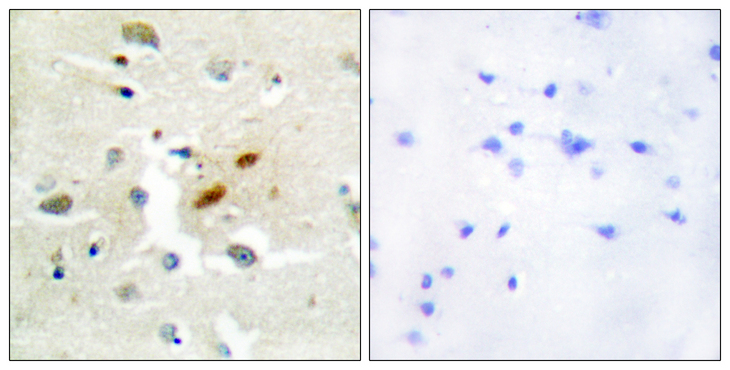 REV3L / REV3 Antibody - Immunohistochemistry analysis of paraffin-embedded human brain tissue, using DNA Polymerase zeta Antibody. The picture on the right is blocked with the synthesized peptide.