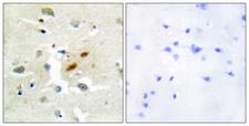 REV3L / REV3 Antibody - Immunohistochemistry analysis of paraffin-embedded human brain tissue, using DNA Polymerase zeta Antibody. The picture on the right is blocked with the synthesized peptide.
