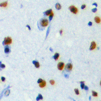 REV3L / REV3 Antibody - Immunohistochemical analysis of DNA Polymerase zeta staining in human brain formalin fixed paraffin embedded tissue section. The section was pre-treated using heat mediated antigen retrieval with sodium citrate buffer (pH 6.0). The section was then incubated with the antibody at room temperature and detected using an HRP conjugated compact polymer system. DAB was used as the chromogen. The section was then counterstained with hematoxylin and mounted with DPX.