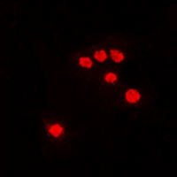 REV3L / REV3 Antibody - Immunofluorescent analysis of DNA Polymerase zeta staining in HEK293T cells. Formalin-fixed cells were permeabilized with 0.1% Triton X-100 in TBS for 5-10 minutes and blocked with 3% BSA-PBS for 30 minutes at room temperature. Cells were probed with the primary antibody in 3% BSA-PBS and incubated overnight at 4 deg C in a humidified chamber. Cells were washed with PBST and incubated with a DyLight 594-conjugated secondary antibody (red) in PBS at room temperature in the dark. DAPI was used to stain the cell nuclei (blue).