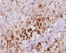 REV3L / REV3 Antibody - 1:100 staining human liver tissue by IHC-P. The tissue was formaldehyde fixed and a heat mediated antigen retrieval step in citrate buffer was performed. The tissue was then blocked and incubated with the antibody for 1.5 hours at 22°C. An HRP conjugated goat anti-rabbit antibody was used as the secondary.