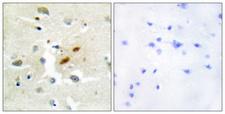 REV3L / REV3 Antibody - Peptide - + Immunohistochemistry analysis of paraffin-embedded human brain tissue, using DNA Polymerase ? antibody.