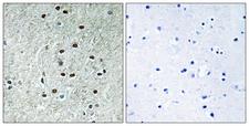 REXO1 / REX1 Antibody - Immunohistochemistry analysis of paraffin-embedded human brain, using REXO1 Antibody. The picture on the right is blocked with the synthesized peptide.