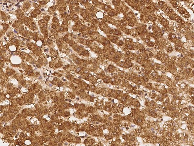 REXO1 / REX1 Antibody - Immunochemical staining of human REXO1 in human liver with rabbit polyclonal antibody at 1:100 dilution, formalin-fixed paraffin embedded sections.