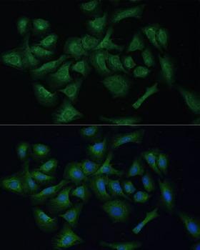 REXO2 Antibody - Immunofluorescence analysis of U-2OS cells using REXO2 Polyclonal Antibody at dilution of 1:100 (40x lens).Blue: DAPI for nuclear staining.