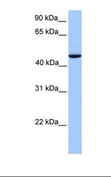 REXO4 / MPMC2 Antibody - Fetal lung lysate. Antibody concentration: 1.0 ug/ml. Gel concentration: 12%.  This image was taken for the unconjugated form of this product. Other forms have not been tested.