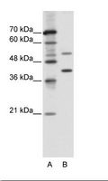 REXO4 / MPMC2 Antibody - A: Marker, B: Jurkat Cell Lysate.  This image was taken for the unconjugated form of this product. Other forms have not been tested.