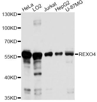 REXO4 / MPMC2 Antibody - Western blot analysis of extracts of various cell lines, using REXO4 antibody at 1:1000 dilution. The secondary antibody used was an HRP Goat Anti-Rabbit IgG (H+L) at 1:10000 dilution. Lysates were loaded 25ug per lane and 3% nonfat dry milk in TBST was used for blocking. An ECL Kit was used for detection and the exposure time was 30s.