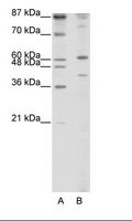 REXO4 / MPMC2 Antibody - A: Marker, B: Jurkat Cell Lysate.  This image was taken for the unconjugated form of this product. Other forms have not been tested.