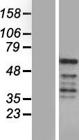 REXO4 / MPMC2 Protein - Western validation with an anti-DDK antibody * L: Control HEK293 lysate R: Over-expression lysate