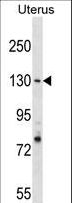 RFC1 / RFC Antibody - RFC1 Antibody western blot of Uterus tissue lysates (35 ug/lane). The RFC1 antibody detected the RFC1 protein (arrow).