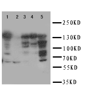 RFC1 / RFC Antibody - WB of RFC1 / RFC antibody. Lane 1: HELA Cell Lysate. Lane 2: SMMC Cell Lysate. Lane 3: JURKAT Cell Lysate. Lane 4: CEM Cell Lysate. Lane 5: 293T Cell Lysate.