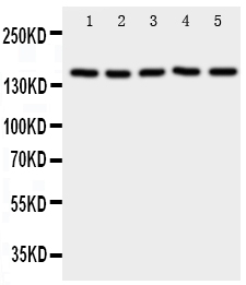 RFC1 / RFC Antibody - Western blot analysis of RFC1 using anti-RFC1 antibody. Electrophoresis was performed on a 5-20% SDS-PAGE gel at 70V (Stacking gel) / 90V (Resolving gel) for 2-3 hours. The sample well of each lane was loaded with 50ug of sample under reducing conditions. Lane 1: HELA Cell Lysate, Lane 2: SMMC Cell Lysate, Lane 3: JURKAT Cell Lysate, Lane 4: CCRF-CEM Cell Lysate, Lane 5: 293T Cell Lysate. After Electrophoresis, proteins were transferred to a Nitrocellulose membrane at 150mA for 50-90 minutes. Blocked the membrane with 5% Non-fat Milk/ TBS for 1.5 hour at RT. The membrane was incubated with rabbit anti-RFC1 antigen affinity purified polyclonal antibody at 0.5 µg/mL overnight at 4°C, then washed with TBS-0.1% Tween 3 times with 5 minutes each and probed with a goat anti-rabbit IgG-HRP secondary antibody at a dilution of 1:10000 for 1.5 hour at RT. The signal is developed using an Enhanced Chemiluminescent detection (ECL) kit with Tanon 5200 system. A specific band was detected for RFC1 at approximately 150KD. The expected band size for RFC1 is at 128KD.