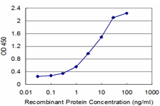 RFC1 / RFC Antibody - Detection limit for recombinant GST tagged RFC1 is approximately 0.3 ng/ml as a capture antibody.