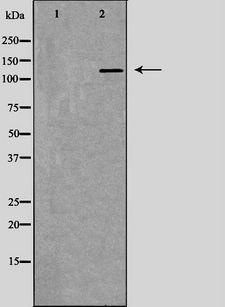 RFC1 / RFC Antibody - Western blot analysis of extracts of MCF-7 using RFC1 antibody. The lane on the left is treated with the antigen-specific peptide.