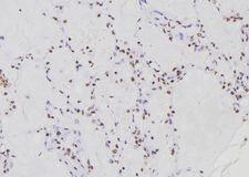 RFC1 / RFC Antibody - 1:100 staining human lung tissue by IHC-P. The sample was formaldehyde fixed and a heat mediated antigen retrieval step in citrate buffer was performed. The sample was then blocked and incubated with the antibody for 1.5 hours at 22°C. An HRP conjugated goat anti-rabbit antibody was used as the secondary.