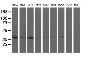 RFC2 / RFC40 Antibody - Western blot of extracts (35ug) from 9 different cell lines by using anti-RFC2 monoclonal antibody (HepG2: human; HeLa: human; SVT2: mouse; A549: human; COS7: monkey; Jurkat: human; MDCK: canine; PC12: rat; MCF7: human).
