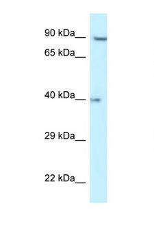 RFC2 / RFC40 Antibody - RFC2 antibody Western blot of HCT15 Cell lysate. Antibody concentration 1 ug/ml.  This image was taken for the unconjugated form of this product. Other forms have not been tested.
