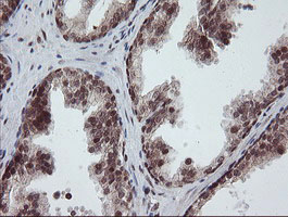 RFC2 / RFC40 Antibody - IHC of paraffin-embedded Human prostate tissue using anti-RFC2 mouse monoclonal antibody.