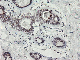 RFC2 / RFC40 Antibody - IHC of paraffin-embedded Human breast tissue using anti-RFC2 mouse monoclonal antibody.